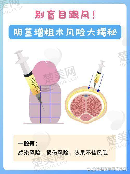 四、浙江大学医学校附属邵逸夫医院——显微技术派