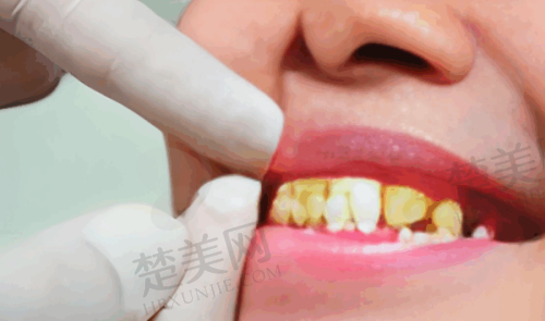 上海鼎植口腔门诊部值得信赖吗?资质、技术、价格、口碑全方位优势给你答案!