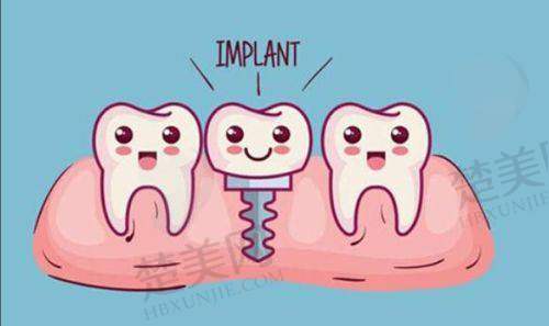 四、威海越雅口腔门诊部特色项目