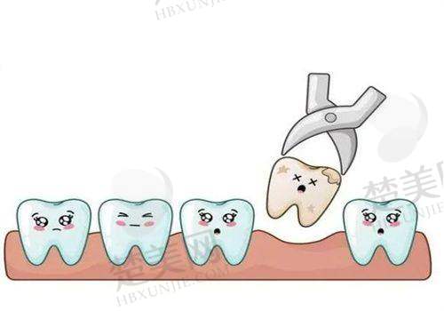 榆次刘双口腔医院拔一颗牙多少钱?普通牙99元起智齿250元起,还有优惠活动!