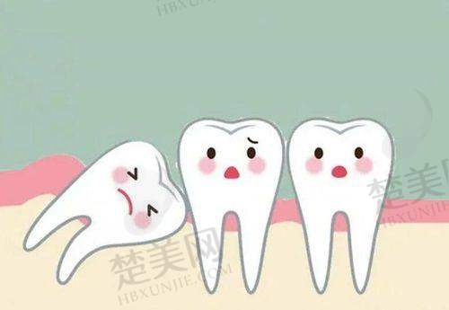 2025全新版北京劲松口腔收费价目表曝光,涵盖种植正畸等多项目费用