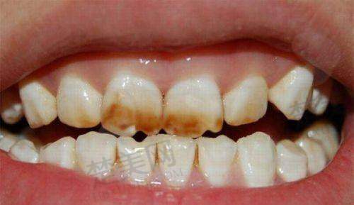 九、宁波一诺口腔诊所真实的患者评价