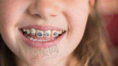 三、威海越雅口腔门诊部诊疗项目有哪些?