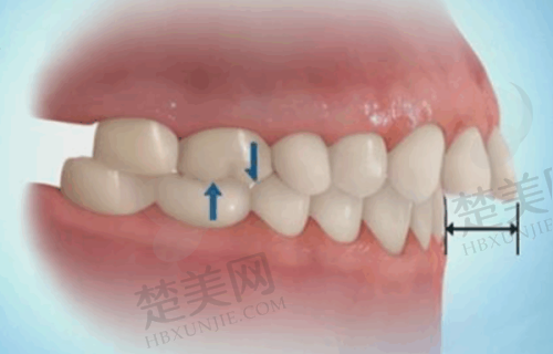 三、宁波一诺口腔诊所诊疗项目有哪些?