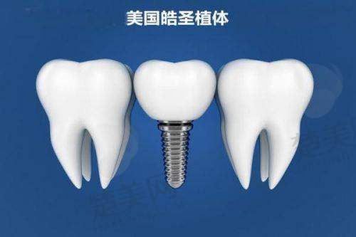 四、宁波一诺口腔诊所特色项目