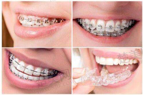 长治贝森口腔医院种植牙医生简介:秦晓中院长20年经验,多项目擅长获患者高度好评