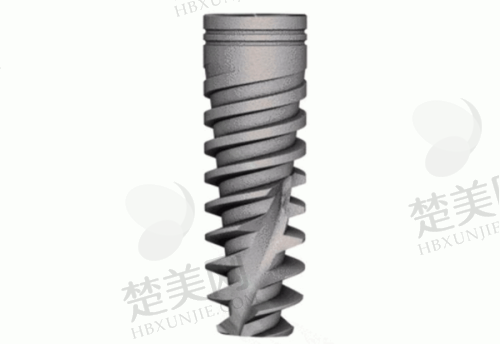 运城美瑞臣口腔种植牙怎么样?技术设备优、医生实力强、价格透明,患者满意度高!