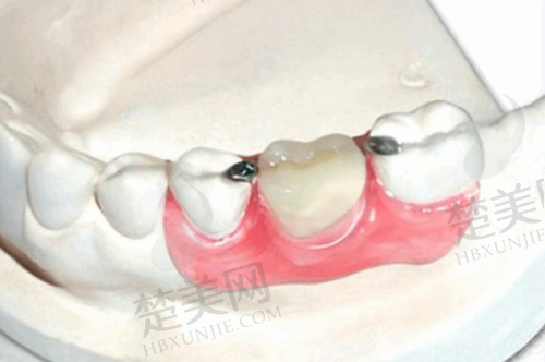 九、威海越雅口腔门诊部真实的患者评价