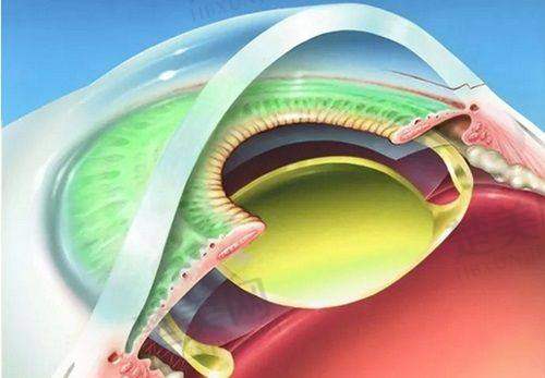 乌鲁木齐普瑞眼科医院挂号预约攻略、地址及乘车路线大揭秘!
