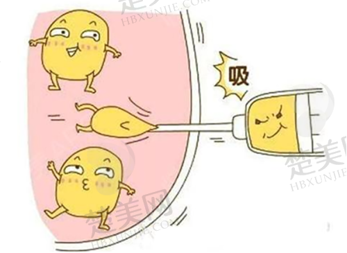 2025新版沈阳杏林整形美容医院价格,双眼皮3680元起费用超划算