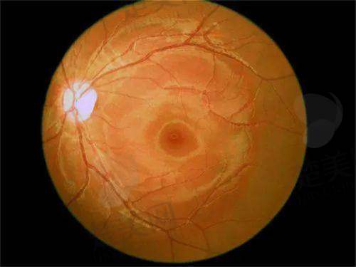 2025北京同仁医院眼科医生排名公布,邱礼新马东丽等技术大咖值得关注