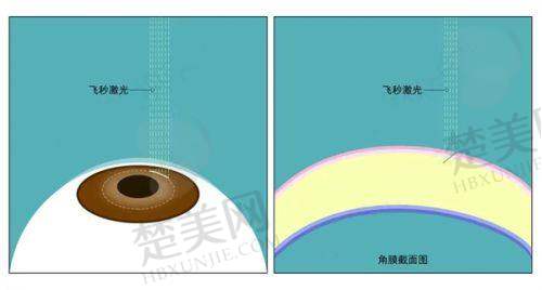 武汉眼科医院公布项目价格表,白内障手术3680元起全解费用明细